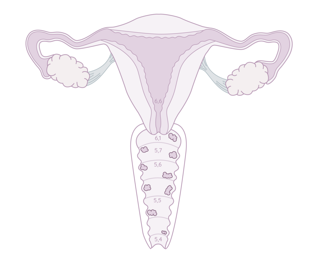 altération pH vaginal